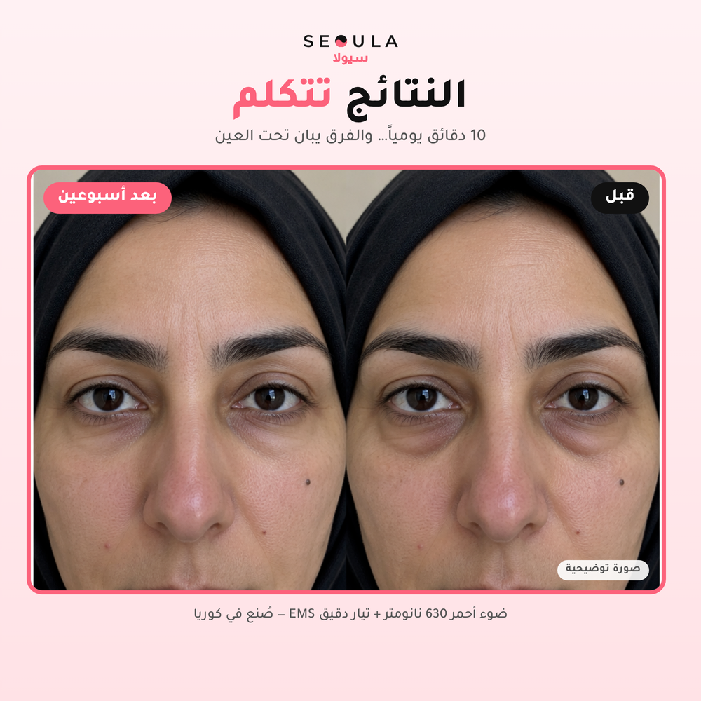 SEOULA Eyes™ Korean Under-Eye Device