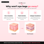 SEOULA Eyes™ Korean Under-Eye Device
