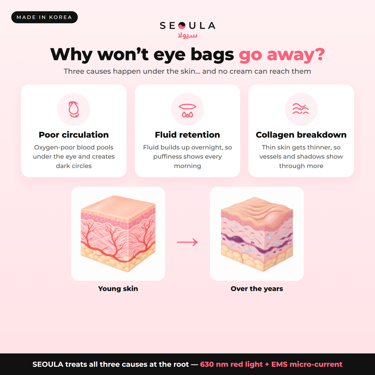 Ageing around the eyes isn't caused by genetics, dehydration or lack of sleep.