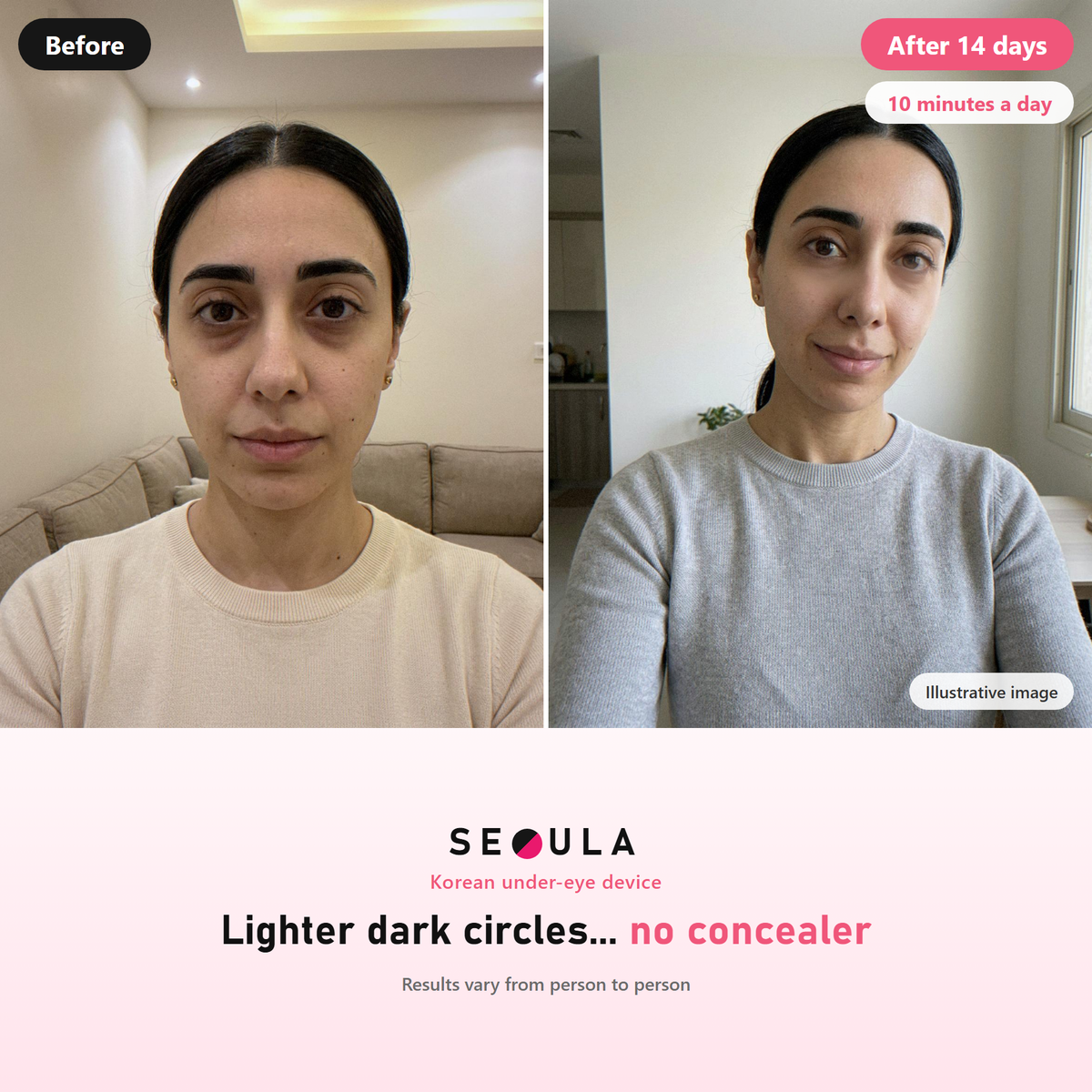 The beauty industry knows very well that eye bags and dark circles are what worry women most.